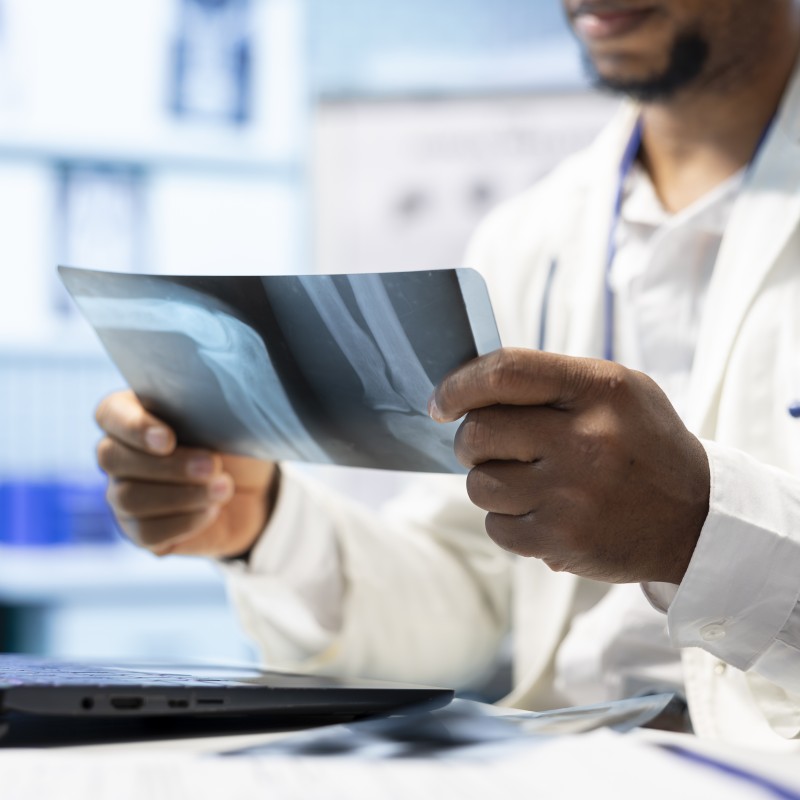 African american doctor analyzing radiography test results recovery plan